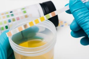 what your urine colour says about you